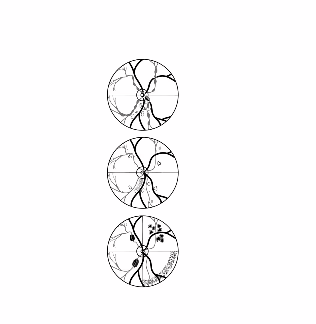 38527/aEc1bZqe19ZfR8PlWfvKI6NrvCow6OP9QU7qfbhQ.png